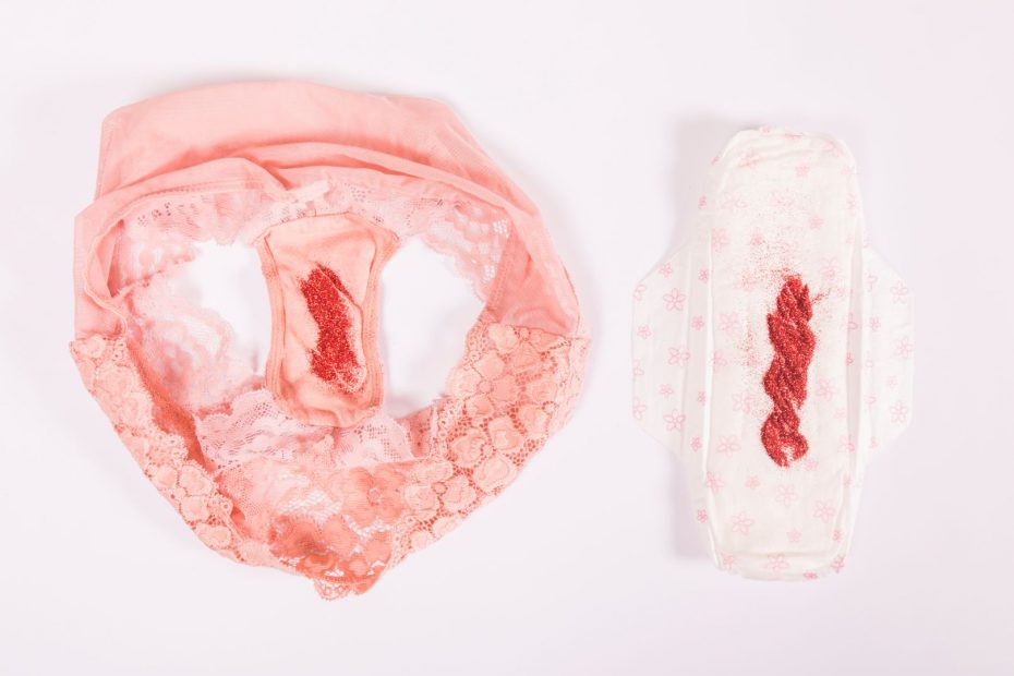 Kelainan Menstruasi yang Harus Kamu Ketahui